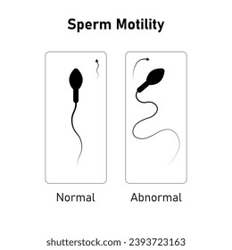 Sperm Motility Scientific Design. Vektorgrafik.