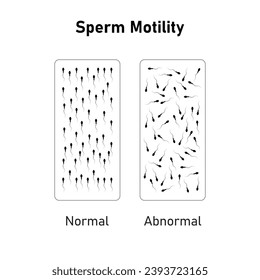 Sperm Motility Scientific Design. Vektorgrafik.