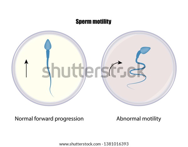 精子の運動性 精液分析 ベクターイラストeps10 のベクター画像素材 ロイヤリティフリー