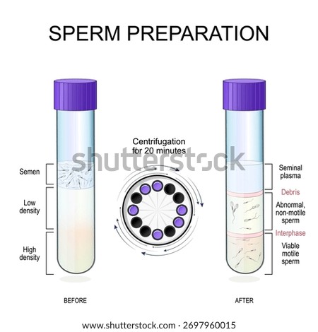 Sperm preparation. Human sperm in Test tube before and after Centrifugation. Layers of Semen after centrifugation: Viable motile sperm, Abnormal sperm, Interphase, debris, Seminal plasma