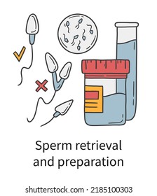 Sperm retrieval and preparation for In Vitro fertilization, male medical procedure for IVF vector illustration in doodle hand drawn style