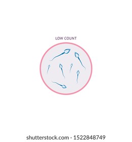 Spermatozoids Morphology Analysis Or Test With Low Count Result Flat Vector Illustration Isolated On White Background. Male Fertility And Human Semen Icon For Health Care.