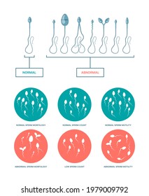 Spermogram. Medical infographic with healthy and damaged spermatozoa birth plan ovulation processes garish vector flat templates