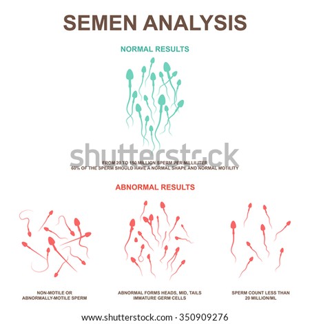 Spermogram and semen parameters, oligozoospermia, asthenozoospermia, teratozoospermia, normal and abnormal sperm