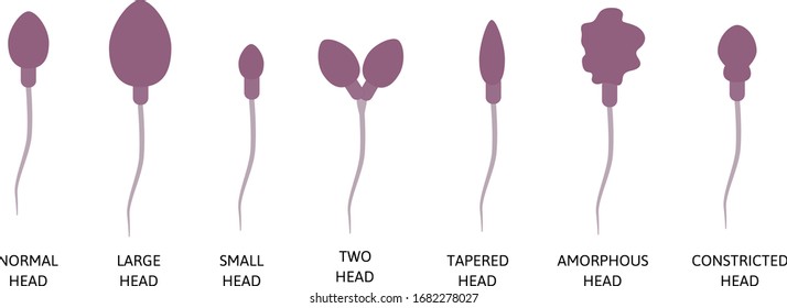Spermogram and semen parameters, teratozoospermia, normal and abnormal sperm. Head defects spermatozoon. normal, large, small, two, tapered head
amorphous, constricted. Colored medial vector 