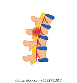 Spinal Cord Injury, Disability Vector Illustration Isolated