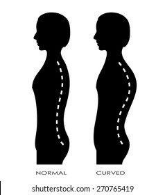 Spinal curvature