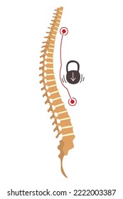 Deformidad medular. Símbolo de curvaturas de espina dorsal o espinas espinosas insalubres. Anatomía de espinas humanas, columna curva. Diagrama con sección marcada. Defecto de postura corporal