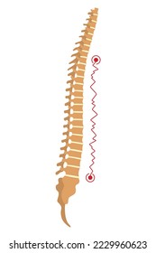 Spinal deformity. Symbol of spine curvatures or unhealthy backbones. Human spine anatomy, curved spine. Diagram with marked section. Body posture defect