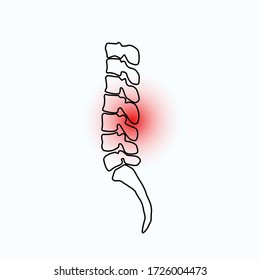 Spinal disease icon. Spondylolisthesis, Foraminal Stenosis, Osteochondrosis symbol