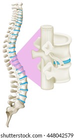 Spinal injury pinched nerve concept