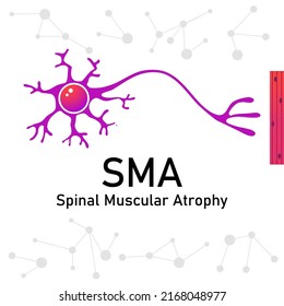 Spinal Muscular Atrophy SMA. Spinal Muscular Atrophy Awareness Month