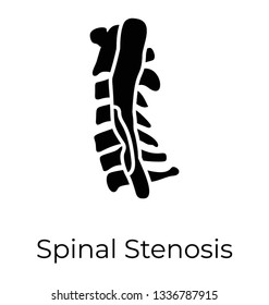 Spinal Stenosis, Solid Vector Icon 