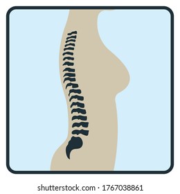 Hueso espinal, icono de concepto xray, imagen del cuerpo humano de roentgen aislada en la ilustración blanca, plana vectorial. Parte esquelética del organismo femenino, silueta de ciencia biológica negra.