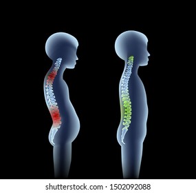 Spine emblem, anatomy human, clinic icon, diagnostic center. Cervical spine skeleton x-ray, medical concept. Spine scoliosis before and after treatment