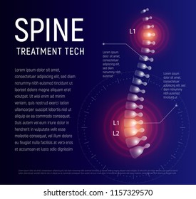 Spine Injury Treatment, Xray Human Back, Healthcare Infographic, Spinal Pain Vector Illustration.