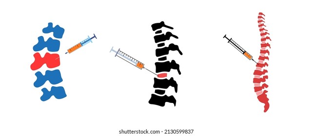 Spine Joint Injection. Pain And Inflammation In The Vertebra. Spinal Arthritis Disease Concept. Medical Research In Spine Center. Backbone Treatment Flat Vector Illustration For Clinic Or Hospital.