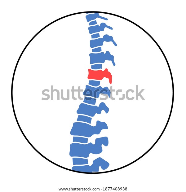 Spine logo for clinic. Spinal pain in\
backbone, rehabilitation center. Scoliosis, osteoporosis, vertebral\
problem. Chiropractic, massage and vertebology concept. Lumbar Xray\
flat vector\
illustration.