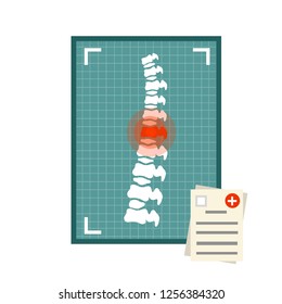Spine on the x-ray image. The bones of the back. Medical document. A red dot of pain. Spinal column injury. Poor posture. Health care. White vertebra. Caroon flat illustration