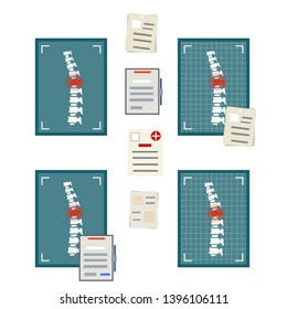 Spine on x-ray image. The bones of the back. Set of Medical document. A red dot of pain. Spinal column injury. Poor posture. Health care. White vertebra. Caroon flat illustration