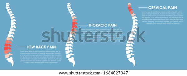 Spine Pain Vector Design Illustration Stock Vector (Royalty Free ...