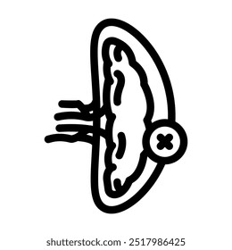 Splenectomía Cirugía línea icono Vector. Splenectomía Cirugía signo. contorno aislado símbolo negro ilustración