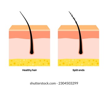 Split ends and hair breakage poster. Head disease and unhealthy hair concept. Effect of temperature on human hair. Skin layers diagram, epidermis, dermis and hypodermis, flat vector illustration.