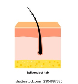 Extremos fraccionados y afiche para el corte de pelo. Enfermedad de la cabeza y el concepto de pelo insalubre. Efecto de la temperatura sobre el cabello humano. Diagrama de capas cutáneas, epidermis, dermis e hipodermis, ilustración vectorial plana.