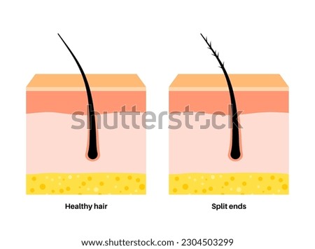 Split ends and hair breakage poster. Head disease and unhealthy hair concept. Effect of temperature on human hair. Skin layers diagram, epidermis, dermis and hypodermis, flat vector illustration.