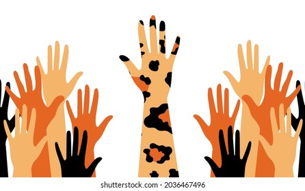 Spotted hands of people in the crowd on a white background. Trendy leopard print. Activists, feminists and other communities are fighting for equality. Vector.