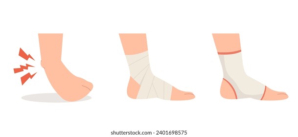 Sprained ankle foot with elastic bandage and ankle support treatments. Concept of twisted ankle, foot pain, bones and ligaments injury, cure, compression bandage wrapping. Flat vector illustration.