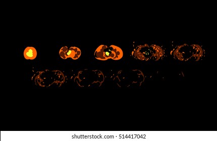 Sprite de una explosión de fuego naranja, un ataque magma u otra cosa. Animación para el juego o la caricatura.