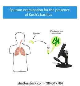 Sputum examination. World Tuberculosis Day. Infographics. Vector illustration on isolated background.
