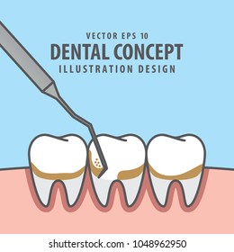 Square banner Scaling teeth illustration vector on blue background. Dental concept.