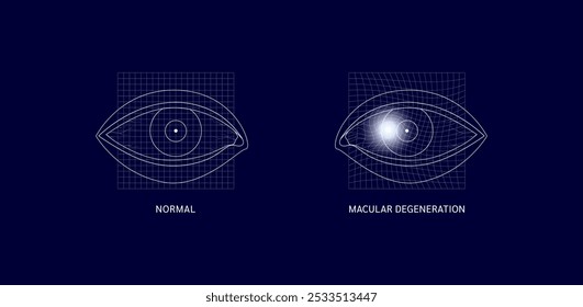 Malha quadrada com pontos brancos no olho. Degeneração macular comum. Visão normal e turva. Causa perda de visão apenas na parte central da imagem. Diagnóstico da ciência médica. Vetor EPS10.