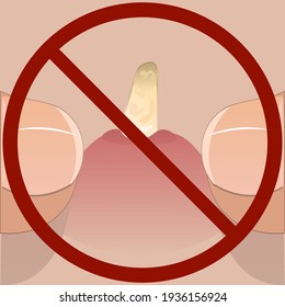 Squeezing out the pimple with your fingers. Vector illustration