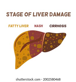 Stage Liver Damage Concept Unhealthy Liver Stock Vector (Royalty Free ...