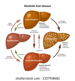 Liver disease svg