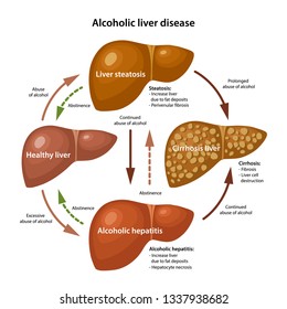 Liver Disease Svg