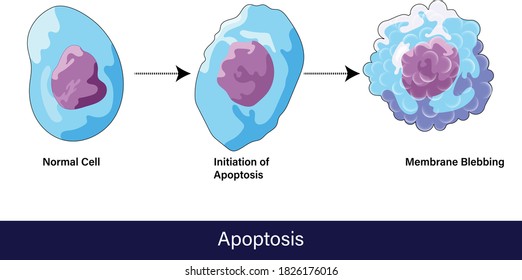 Stages of apoptosis from normal cell to final stage of formation of membrane blebbing vector