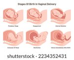 Stages of baby birth in vaginal delivery. Fetus movement during the labor. Biology and gynecology. Flat vector illustration