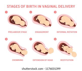 Stages of baby birth in vaginal delivery. Fetus movement during the labor. Biology and gynecology. Isolated vector illustration