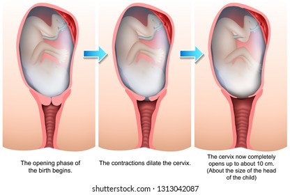 Stages of birth 3d medical vector illustration
