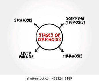 Etapas de cirrosis (cicatrización del hígado causada por daño hepático a largo plazo) concepto de mapa de la mente para presentaciones e informes