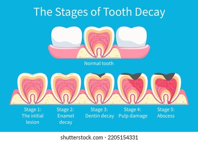 10,948 Dental Medical Education Images, Stock Photos & Vectors ...