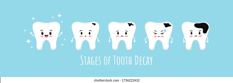 Stages of emoji tooth decay icon set. Cute kawaii teeth on different stages of dental caries development. Flat cartoon emoji character vector illustration. Kids dental hygiene and treatment concept.