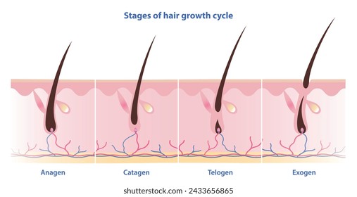 Stages of hair growth cycle vector isolated on white background. Hair grows in four distinct stages. Anagen, growing phase. Catagen, transition phase. Telogen, resting phase. Exogen, shedding phase.