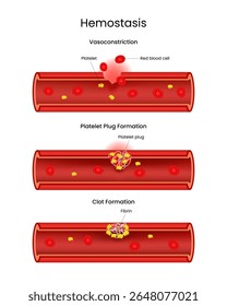 Estágios da Hemostase Vasoconstrição, Plaquetas e Formação de Coágulos