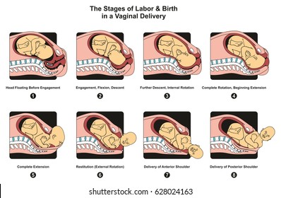 Stages of Labor and Birth in a vaginal delivery infographic diagram including engagement descent internal complete rotation extension poster for medical science education and healthcare