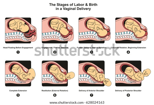 Stages of Labor and Birth in a vaginal\
delivery infographic diagram including engagement descent internal\
complete rotation extension poster for medical science education\
and healthcare